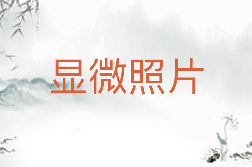 显微照片